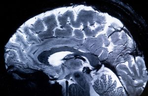 Group raises brain health awareness at Ibadan market