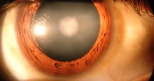 Don’t Let Your Sight Slip Away